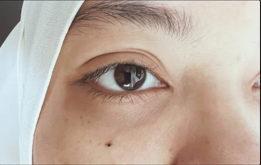 Before lash lift, client example 2