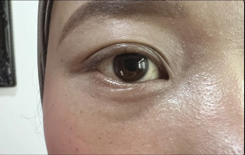 Before lash lift, client example 8